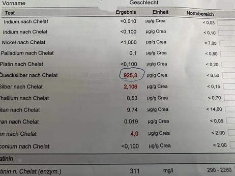 患者螯合后的汞含量高达925.3μg/g